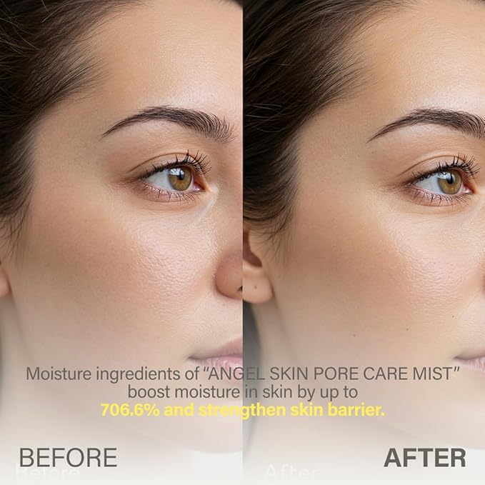 KEYTH ANGEL SKIN PORE CARE MIST (150ML, 5.07 FL.OZ.) / Sebum Control, Pore Tightening, Wrinkle Improvement, Avocado Esters, Orthosiphon Stamineus Extract