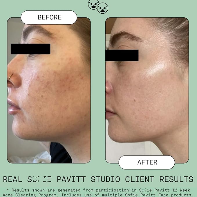 Pavitt Face Nice Ice Frozen Toner Pods, Cryo Treatment with Niacinamide and Green Tea, Reduces Puffiness - 3 Count | Limited Edition