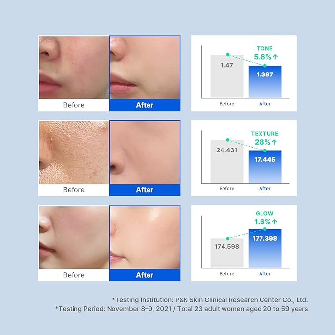 idplacosmetics Real After Care Bubble Glow Toner 5.07 fl.oz (150 ml) — Micro-Bubble with 42% Rice Bran Water & Gentle AHA/PHA/LHA Exfoliation Hydrating Korean Toner for Smoother Look