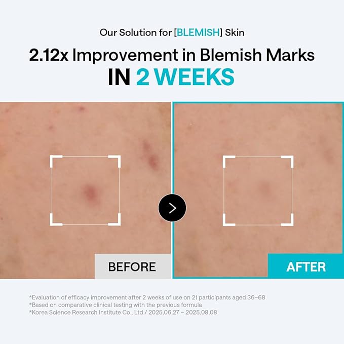 Mediheal Madecassoside Blemish Repair Skincare Bundle – Toner Pads (100ct) + Repair Serum + Derma Cream | Centella Asiatica Tone Care, Hydration & Skin Barrier Support