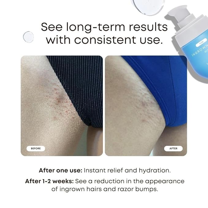 Bushbalm Ingrown Hair Oil - Helps Prevent and Repair Skin from Ingrown Hairs, Razor Burn & Underarm Bumps - Soothe Skin from Post Shave Itchiness, Irritation and Redness, 30 ml - Nude Oil