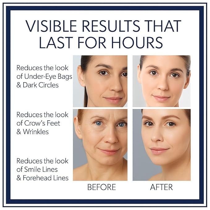 Instant Firming Eye Serum, Anti-Aging Formula for Under Bags and Wrinkles, Under Eye Cream-10ml,0.35 oz, Wrinkle Filler, Visibly Improves for Bags Dark Circles Treatment for Puffines (Scented)