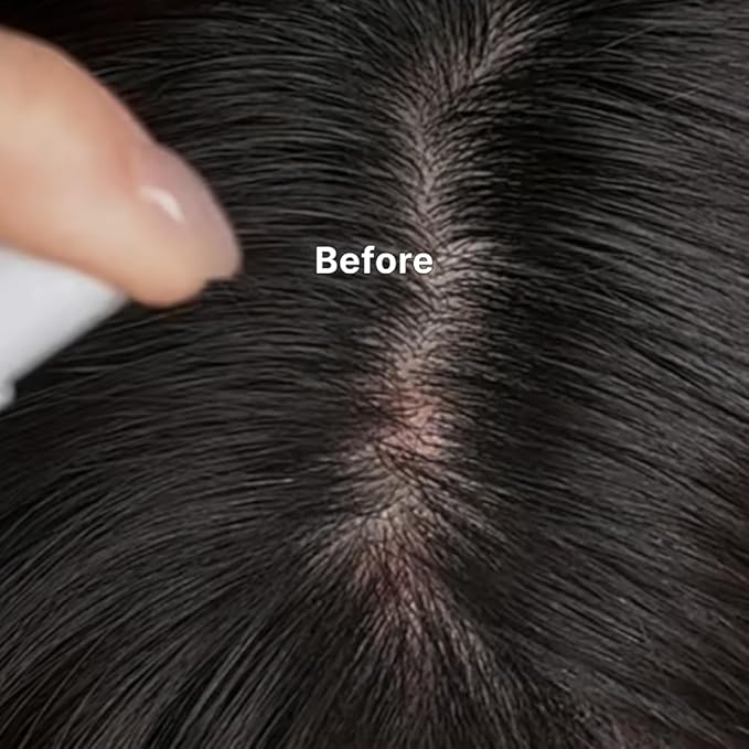 Kelp Scalp Serum – Hydrating Scalp Treatment for Dry & Itchy Scalp | Korean Hair Growth & Scalp Care Serum | 2.7 fl oz / 80 ml