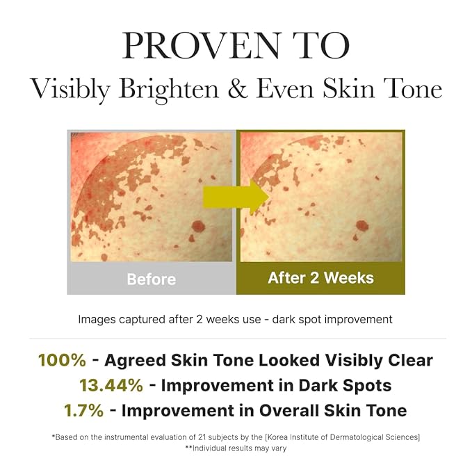 Arencia Vitamin C Booster Shot Serum with Glutathione, Niacinamide and Vitamin E for Dark Spot Care, Fine Lines & Wrinkles, Glass Skin, Korean Skincare 10ml/0.33 fl.oz