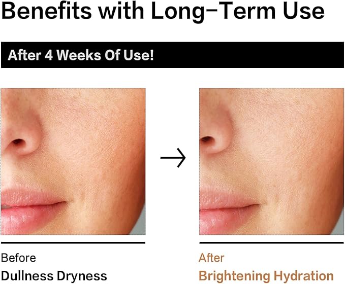 Rice Toner with Aloe Leaf Water, Niacinamide and Centella Asiatica, Milky Toner for Soothing and Glowing Skin, Vegan, Alcohol and Fragrance Free