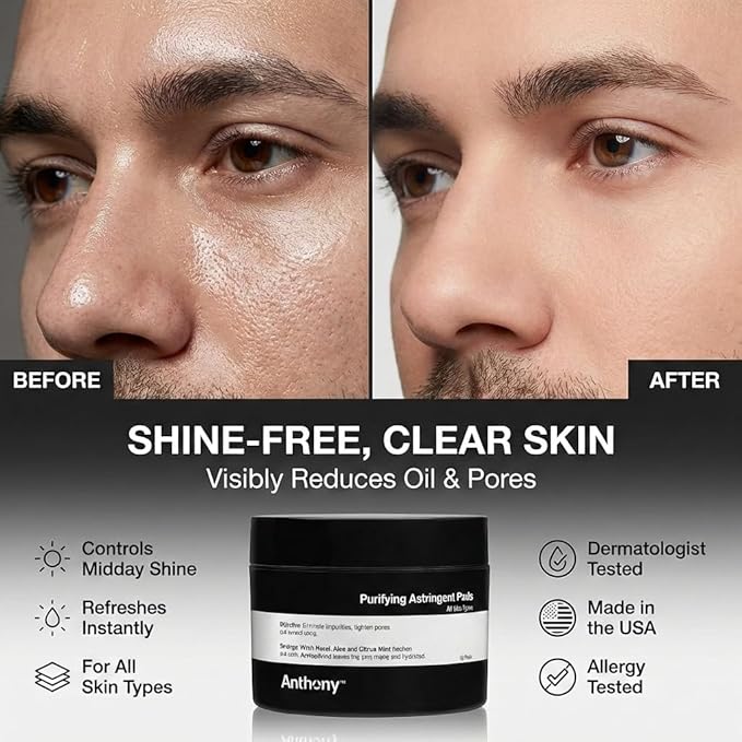 Anthony Witch Hazel Pads Pore Cleaner: 60 Count, Purifying Astringent Cleansing Toner Pads – Aloe Vera, and Citrus Mint, Eliminate Impurities, Minimize Pores and Control Shine