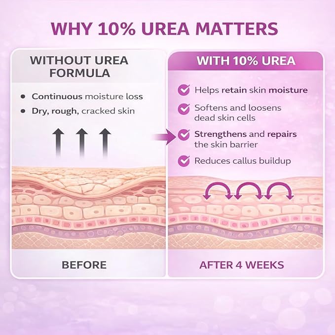 10% Urea Cream with Aloe Vera, Jojoba Oil and Salicylic Acid - 150ml Hydrating Moisturizer for Dry, Chapped Hands, Feet, Face & Body - Repairs, Soothes & Nourishes Rough, Dry Skin - 4 Oz