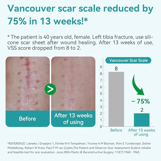 Dimora Medical Grade Silicone Scar Sheets - Ultra Soft Silicone Scar Tape (1.6”x120" Roll), Waterproof Scar Treatment for Surgical Scars, C Section, Tummy Tuck, Keloid Treatment