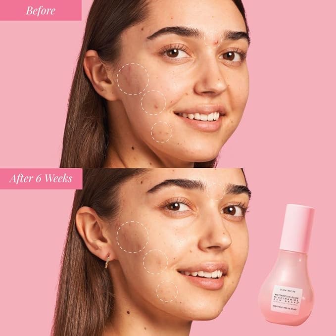 Glow Recipe Cloudberry Brightening Essence Toner (75 ml) - CoQ10 Face Toner to Strengthen Skin Barrier + Niacinamide Dew Drops Facial Serum & Illuminating Makeup Primer for Glowing Skin (15 ml)