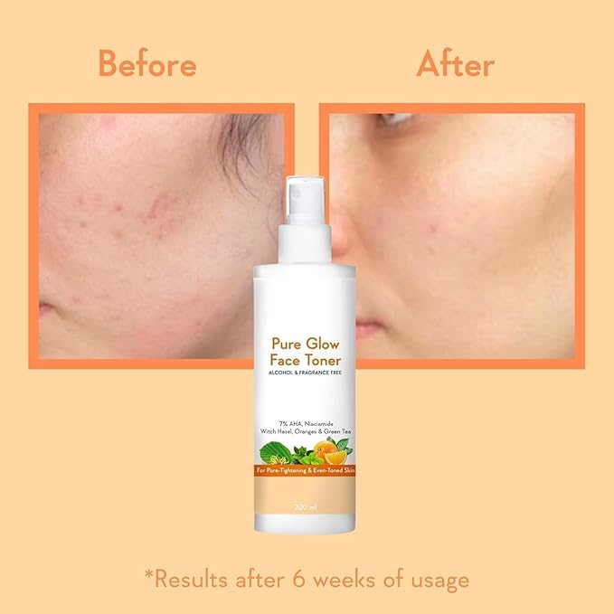 Pure Glow Face Toner - 5% Fruit AHA, Hyaluronic Acid, Niacinamide & Oranges,200ml
