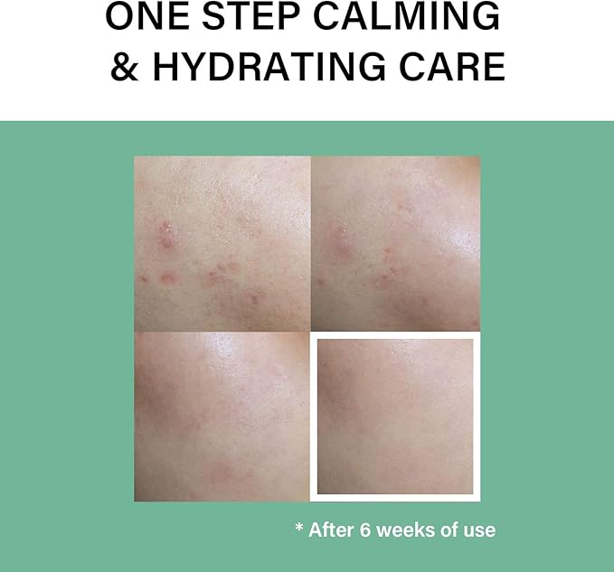 celimax The Real CICA Calming Ampoule - with 75% Centella Asiatica Extract, 1.35 fl oz