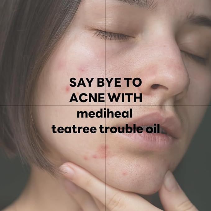 Mediheal Teatree Trouble Calming Oil (0.33 fl oz), Quick Calming and Deep Hydration with Control Excess Oil for Sensitive Skin Type