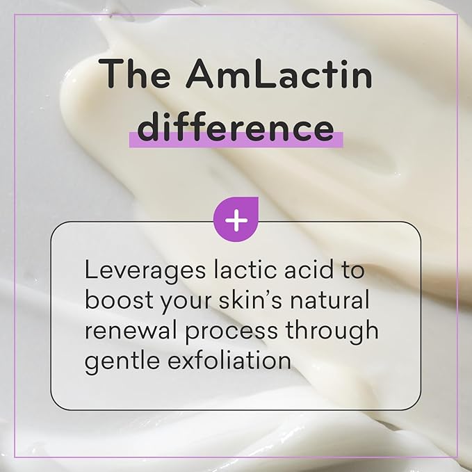 AmLactin Ultra Smoothing - Therapeutic Hand Cream for Dry Cracked Hands - No-Scrub Exfoliator and Moisturizer with 15% Lactic Acid AHA, 4.9 oz (Packaging May Vary)