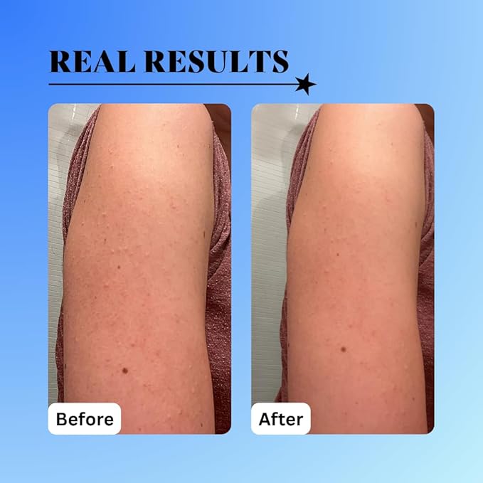10% Glycolic Exfoliating Treatment Tonic (1oz)