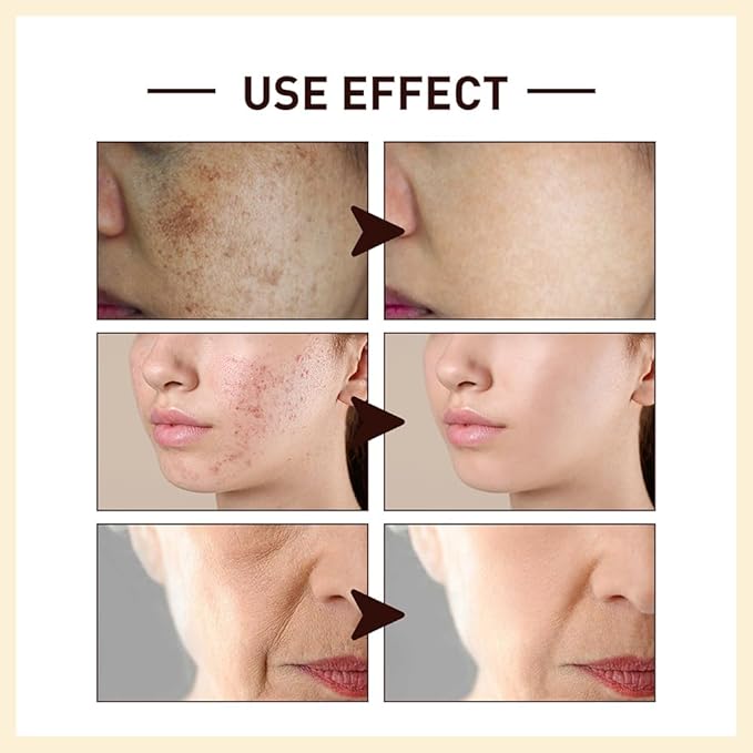 Rice Toner, Rice Extract Moist Toner, Niacinamide Facial Essence, Delicate & Tender, Deep Moisturize, Hydrating for Dry Skin (1)