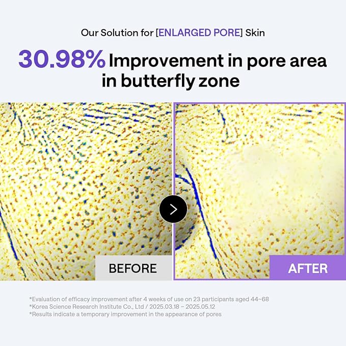 Mediheal PDRN Pad & Serum Skin Care Duo Set for Glass skin – PDRN Lifting Toner Pads (100 Count) + PDRN Lifting Serum (1.35 fl.oz)