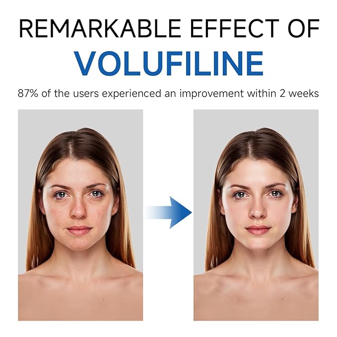 Volufiline Serum, Volufiline Under Eye Serum, Cosmetic Grade Ampoule for Skin Elasticity Improvement, Face & Body Fine Lines, Hydrating Texture, 10ml*2