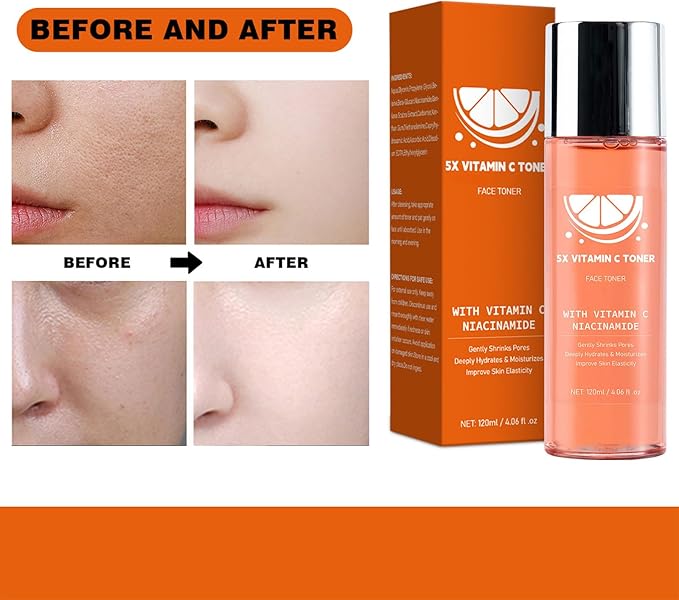 Toner for Face, with Vitamin C Niacinamide Gentiana Scabra Extract, Even Skin Tone, Pore Minimizing, Oil Control,Locks in Moisture,4.06 fl.oz