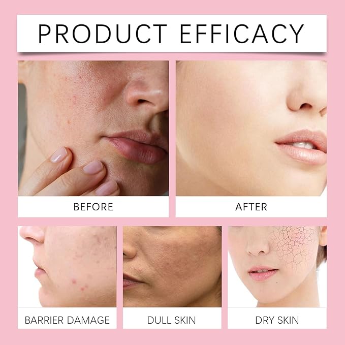 Hydrating Toner For Face - Moisturizing & Repairing, Soothes Damaged Skin, Controls Oil, Leaves Skin Clear & Tender(1PCS)