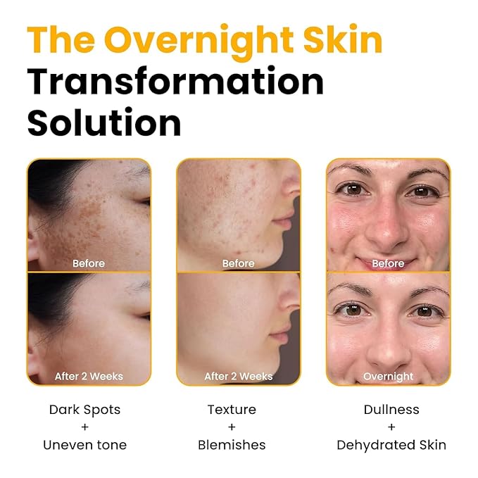Peel Off Mask,Collagen Face Mask, Hydrating Overnight Hydrogel Mask,Gentle Skin Care, Pore Minimizing - Korean Skincare -Elasticity Improvement - Better Than Sheet Masks