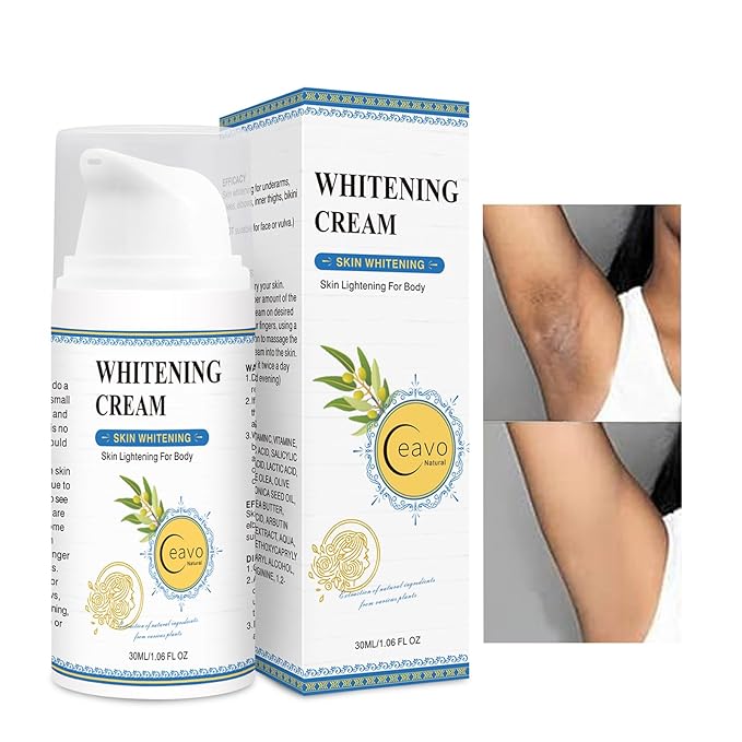 Skin Lightening Cream for Intimate Area with Niacinamide, Arbutin, Tranexamic Acid and Vitamin C, Even Skin Tone for Body, Underarm, Knees, Elbows, Inner Thigh, Bikini Areas Bleaching Whitening Cream