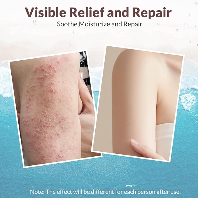 Crogooe Natural Soothing Eczema Cream for Dry & Itchy & Sensitive Skin - Fragrance-Free Moisturizer with Sea Moss, Aloe Vera & Oats for Intense Hydration & Comfort ，Safe for All Ages (4 oz)
