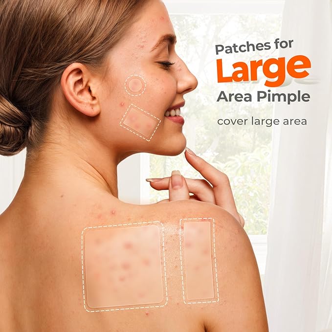 TKTK Large Pimple Patches for Face, 7 Sizes XL Acne Patches, Big Hydrocolloid Bandages for Body, Chin, Forehead, Chest, Back Zit Breakouts, Hydrocolloid Patch (Strip, Square, Dot 126 Count)