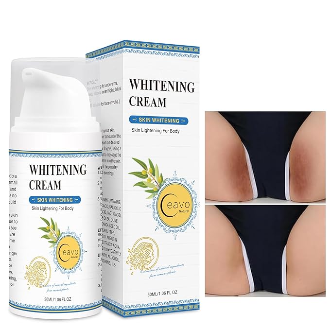Skin Lightening Cream for Intimate Area with Niacinamide, Arbutin, Tranexamic Acid and Vitamin C, Even Skin Tone for Body, Underarm, Knees, Elbows, Inner Thigh, Bikini Areas Bleaching Whitening Cream