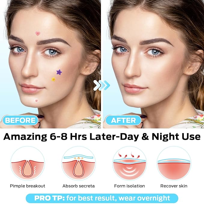 Pimple Patches for Face, Cute Pimple Patches Stars, Colorful Hydrocolloid Acne 271Patches 6 Sizes with Salicylic Acid, Tea Tree & Centella Oil (Round,Star,Peach Shapes)