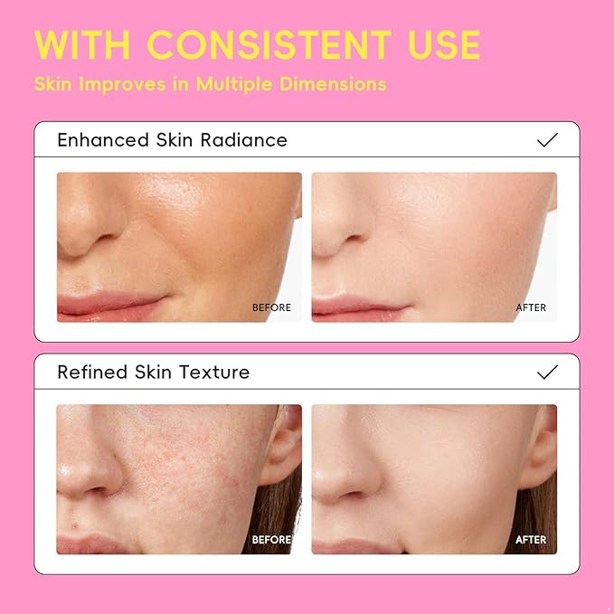 Yeahdor Balancing Mist Toner 100ml, Hydrating Face Essence for Oily Skin, Daily Soothing Water for Refined Pores Pink One Size