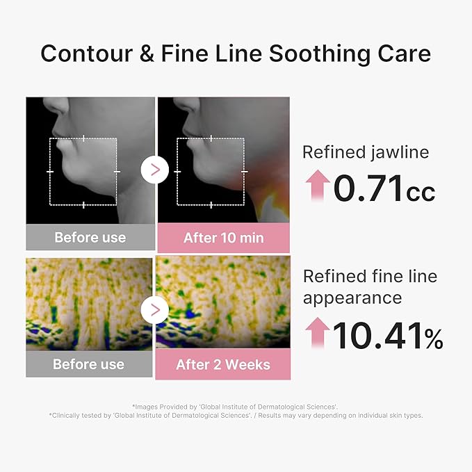medicube PDRN Pink Tension Up Mask | 3-Step V-line Mask for Contoured-Looking Chin & Jawline | Full-Face Firming Care with Salmon PDRN, NAD & Caffeine | Korean Skincare, 34g x 4ea + Tightening Band