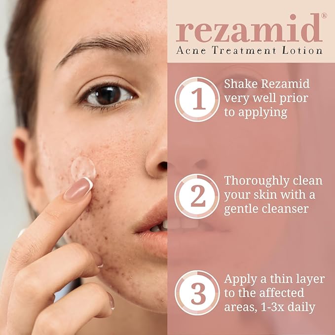 Acne Spot Treatment Lotion For Pimples - Skin Clearing Blemish Concealer For Oily Skin With 5% Sulfur & 2% Resorcinol - Sensitive Skin Makeup - Skin Tone Matching Foundation - 2oz