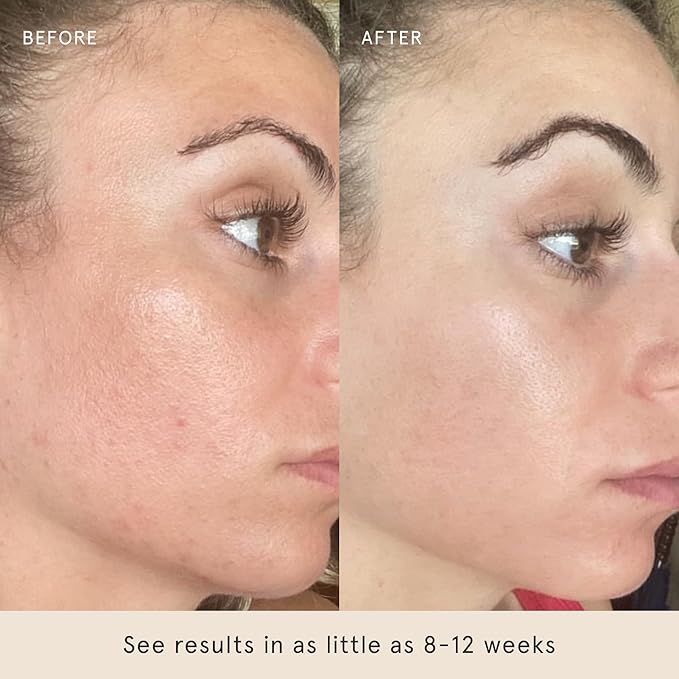 Barefaced Year-Round Essentials Bundle - Toning Pads, Tinted SPF, Sheer SPF, & Overachiever - Exfoliate, Renew, & Protect Skin Every Season
