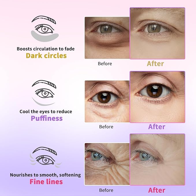 Under Eye Patches for Dark Circles, Puffiness, Fine Lines, Eye Mask Set with Retinol, 24K Gold, Caffeine, Gel Mask for Easter, Birthday & Spa Party Favors, Easter Basket Stuffers, 24 Pairs