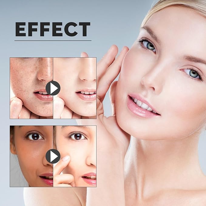 Hydrating Facial Toner - Fades Acne Marks/Spots, Boosts Collagen, Tightens Pores, Brightens & Moisturizes Skin(2PCS)