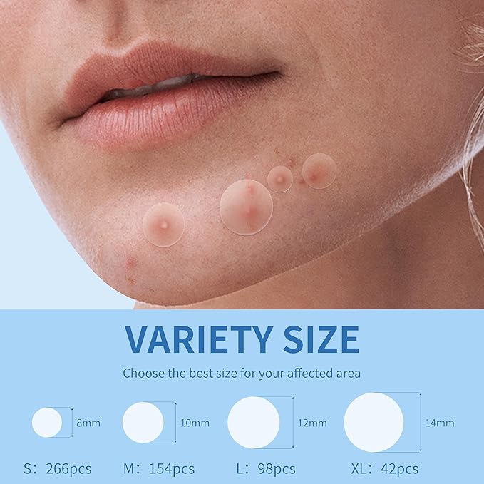 Pimple Patches for Face - 4 Size 560 Counts Hydrocolloid Acne Patches for Covering Zits and Blemishes, Spot Stickers with Salicylic Acid, Tea Tree Oil & Calendula Oil
