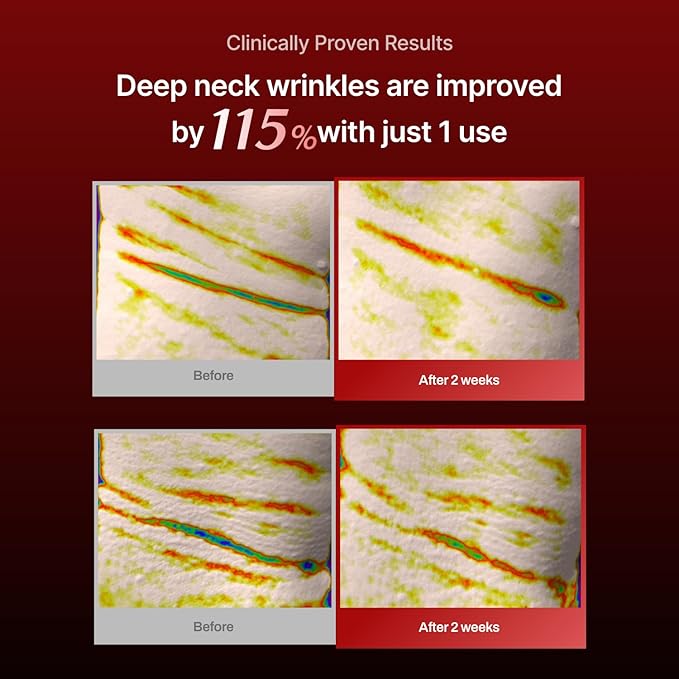Wrinkle-fit Neck Mask - Neck Wrinkle Patches, Firming and Tightening Korean Deep Collagen Masks - Hyaluronic Acid NeckTargeted Mesh Sheet Mask for Lifting Sagging Skin - Boosting Elasticity 7EA