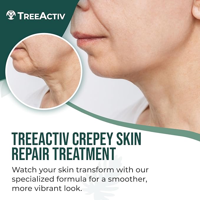 TreeActiv Crepey Skin Repair Cream, 8 oz Firming Body & Neck Cream with Hyaluronic Acid, Glycolic Acid & Shea Butter, Helps Crepey Skin Look Smoother, 500+ Uses