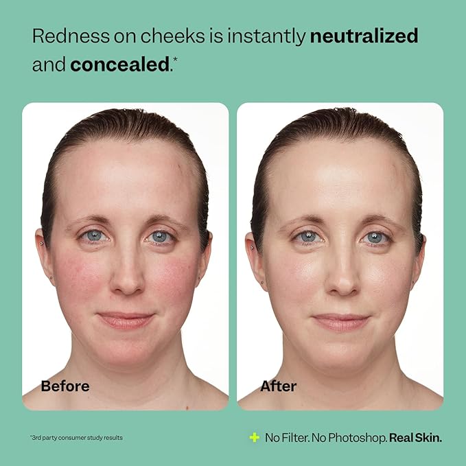 Peach Slices - Redness Relief Color Correcting Moisturizer (1.69 oz) - Hydrate & Conceal - Visibly Reduce Redness & Irritation - Panthenol, Cica, Algae - Vegan, Cruelty Free, Korean Skin Care & Beauty
