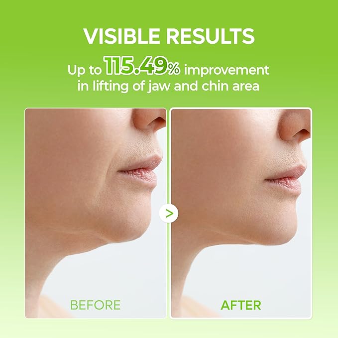 Dr.Melaxin CACTOX V-LIFTING MEWING BAND with Cactus Cooling Reduce Puffiness & Pore Tightening for Visible Pore Care Skin Repair