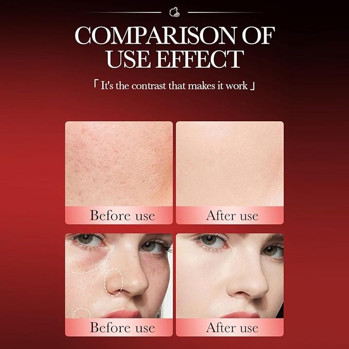 Mushroom Head Air Cushion CC Cream, Long-Lasting Concealer BB Cream Moisturizing Color Corrector Foundation Makeup, Even Skin Tone for All Skin Types, Natural