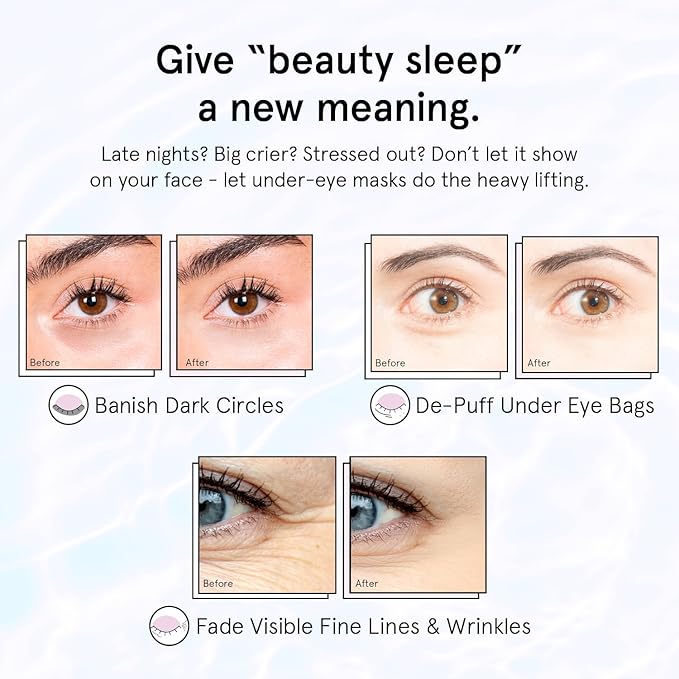 grace & stella Retinol Under Eye Patches for Puffy Eyes and Dark Circles, Restoring Gel Under Eye Masks with Hyaluronic Acid - Vegan Cruelty-Free Skincare - Gifts for Girlfriend (Purple, 6 Pairs)