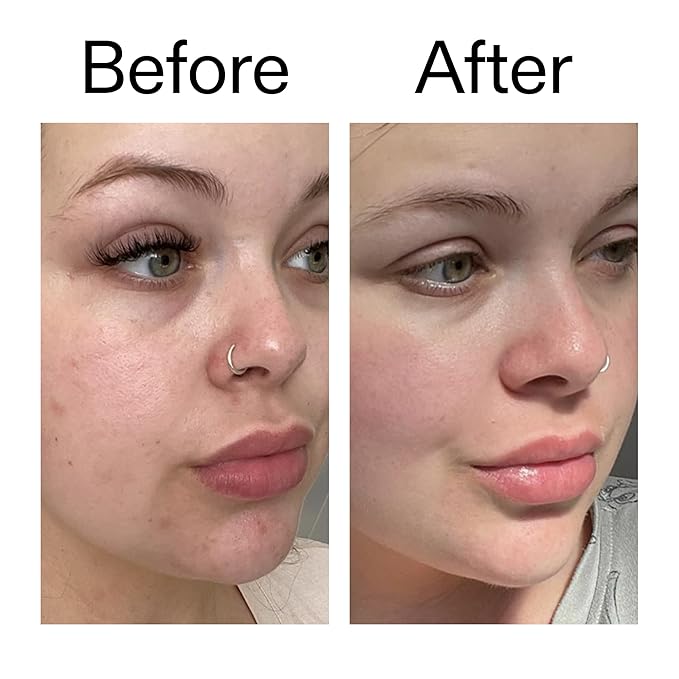 The INKEY List Omega Water Cream 1.69 fl oz/50ml, Oil-Free Face Moisturiser, Lightweight Gel, Vegan Friendly Skincare, Suitable For Blemish Prone Skin