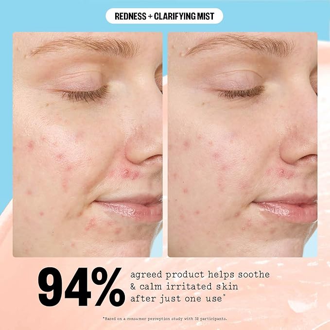 PEACE OUT Redness + Clarifying Mist, Hypochlorous Acid Facial Spray for Acne-Prone Skin, Helps Calm Redness, Control Excess Oil, and Refresh Skin Over and Under Makeup, 3.3 fl oz