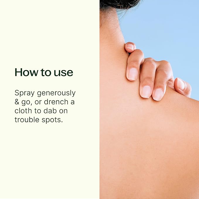 Plant Therapy After Sun Spray 4 oz, Natural Sunburn Relief, Instantly Soothes & Supports Skin Recovery, Reduces Discomfort from Irritated Skin, Includes Aloe Vera