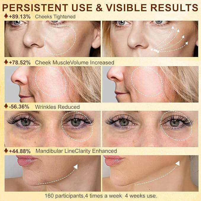 Microcurrent Facial Device, Skin Tightening Face Machine Treatment of Facial Wrinkles and mild to Moderate inflammatory
