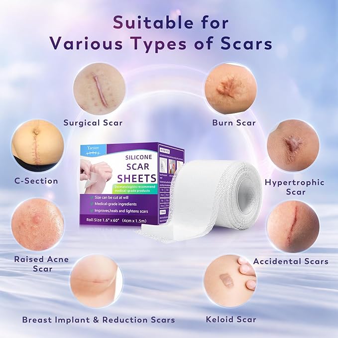 Silicone Scar Sheets, Silicone Scar Tape(1.8"x 157" Roll-4M), Medical Grade Scar Sheets, Scar Tape for Surgical Scars, Burn, C-Section, Keloid Scars, Acne Treatment, Stretch Marks Removal