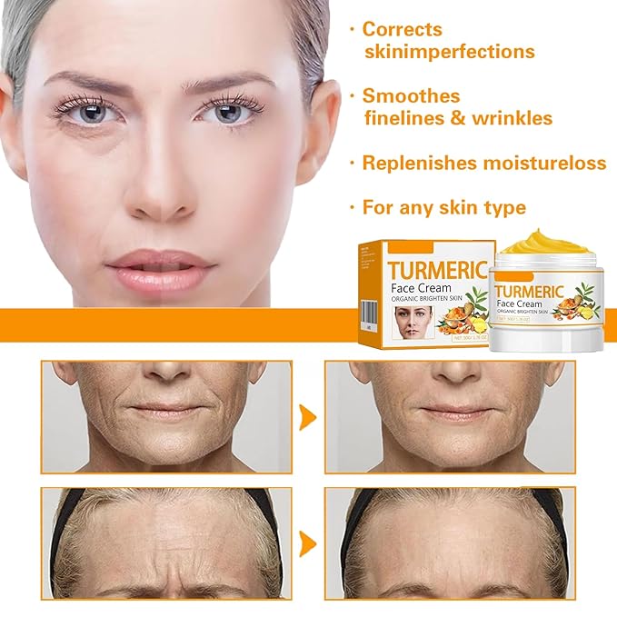 Turmeric Face Cream – Natural Turmeric Moisturizer Cream For Dark Spots Remover,Evens Skin Tone, Face Cream Smoothes Fine Lines, Daily Moisturizer For Face And Body