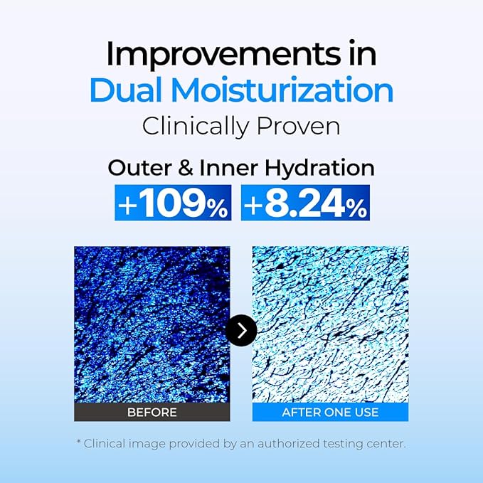 IZEZE Soul HNA Hydro Toner 5.07 fl.oz, 150 ml | Hyaluronic Acid, Dry Skin, Korean Skincare for Hydrating, Cypress Water for Hydration, Skincare Coreano