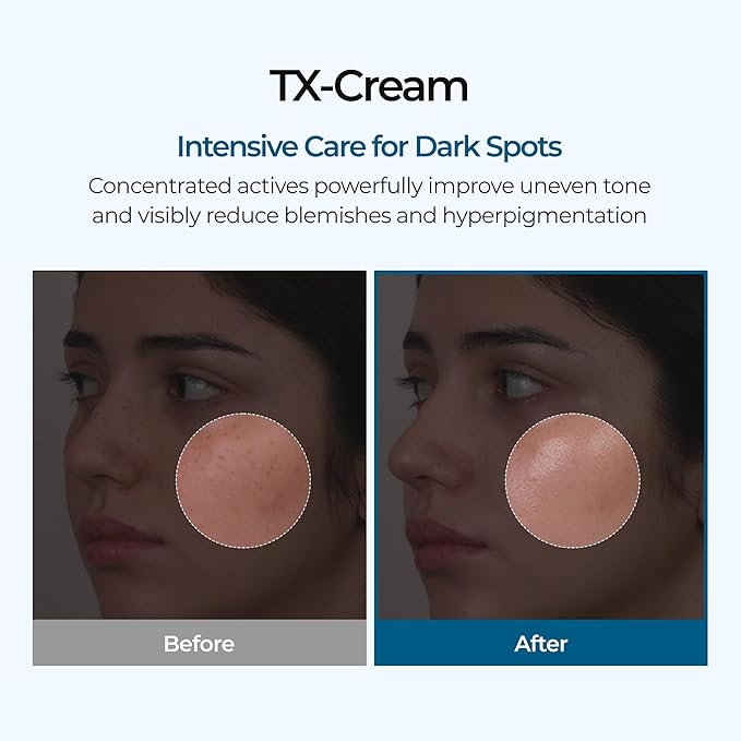 DR.Melaxin TX Tranexamic Acid CREAM | Skin freckle Cream, Blemishes, Anti-pigmetation korean skin care | Korean Cosmetics | 1.7 fl oz (50 ml)